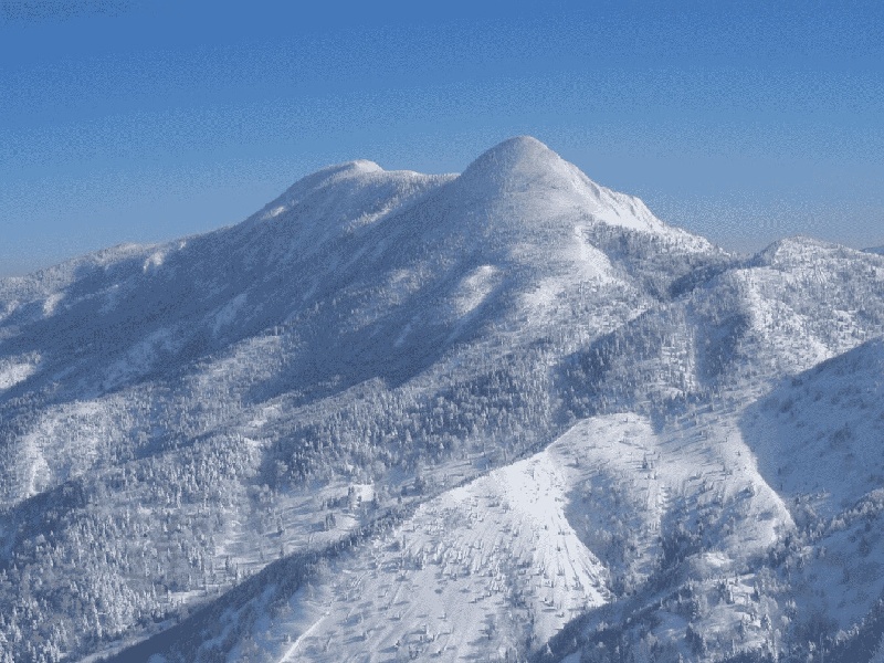 太原阿娇试管版（试管移植有丝）